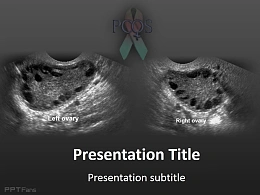 医学医药行业卵巢ppt模板