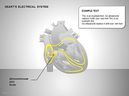 心电系统房室结图示说明