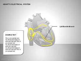 心电系统左束支图示说明