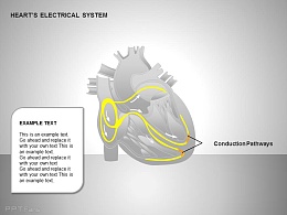 心电系统传导通路图示说明