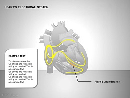 心电系统右束支图示说明