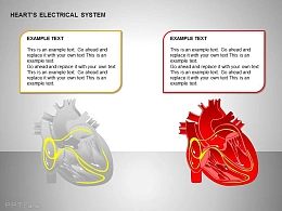 两方面心电系统效果图